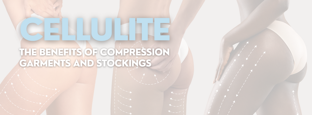 Can Compression Stockings Help Cellulite?